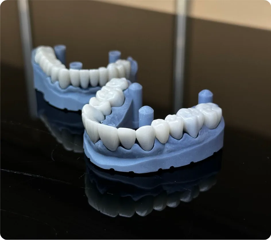 3D printed dental models with ceramic crowns on a reflective black surface